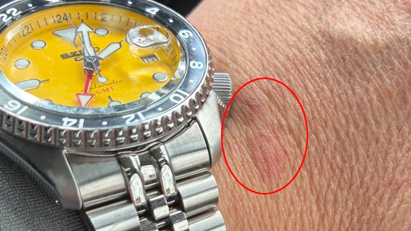 The crown pressing against the back of my hand.